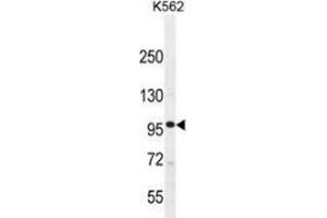 Western blot analysis in K562 cell line lysates (35ug/lane) using MLCK Antibody .