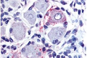 Human Spinal Cord, Dorsal Root Ganglion (formalin-fixed, paraffin-embedded) stained with GPR149 antibody ABIN213495 at 20 ug/ml followed by biotinylated goat anti-rabbit IgG secondary antibody ABIN481713, alkaline phosphatase-streptavidin and chromogen. (GPR149 抗体  (Cytoplasmic Domain))