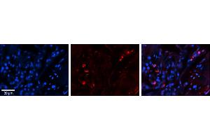 Rabbit Anti-SELENBP1 Antibody     Formalin Fixed Paraffin Embedded Tissue: Human Lung Tissue  Observed Staining: Cytoplasmic, membrane and nuclear in alveolar type I & II cells  Primary Antibody Concentration: 1:100  Other Working Concentrations: 1/600  Secondary Antibody: Donkey anti-Rabbit-Cy3  Secondary Antibody Concentration: 1:200  Magnification: 20X  Exposure Time: 0. (SELENBP1 抗体  (C-Term))