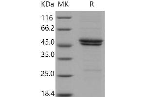 Western Blotting (WB) image for Interleukin 11 Receptor, alpha (IL11RA) (Active) protein (His tag) (ABIN7196371)