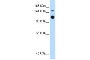 WB Suggested Anti-GAPVD1 Antibody Titration:  0.