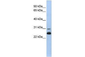 WB Suggested Anti-AK1 Antibody Titration:  0. (Adenylate Kinase 1 抗体  (N-Term))