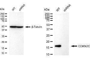 Western blotting analysis using CDKN2C antibody (ABIN7798229).
