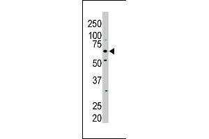 The anti-PKLR Pab (ABIN391050 and ABIN2841209) is used in Western blot to detect PKLR in NIH/3T3 cell lysate. (PKLR 抗体  (N-Term))