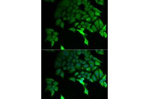 Immunofluorescence analysis of U2OS cells using TSC22D3 antibody (ABIN5974107). (TSC22D3 抗体)