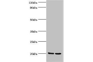 Western blot All lanes: GLO1 antibody at 2 μg/mL Lane 1: HepG2 whole cell lysate Lane 2: Hela whole cell lysate Secondary Goat polyclonal to rabbit IgG at 1/10000 dilution Predicted band size: 21, 20 kDa Observed band size: 21 kDa (GLO1 抗体  (AA 1-184))