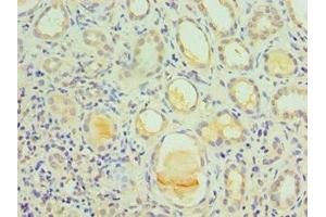 Immunohistochemistry of paraffin-embedded human kidney tissue using ABIN7156743 at dilution of 1:100 (IL1R1 抗体  (AA 18-320))