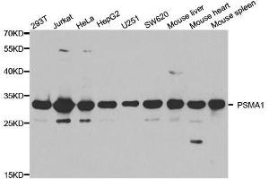 Western blot analysis of extracts of various cell lines, using PSMA1 antibody. (PSMA1 抗体  (AA 1-263))