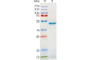 SDS-PAGE (SDS) image for Interleukin 18 (IL18) (AA 37-197) protein (mFc Tag) (ABIN7092723)