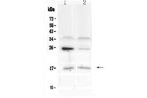 Western blot analysis of IL1F10 using anti-IL1F10 antibody . (IL1F10 抗体  (AA 1-152))