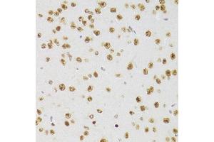 Immunohistochemistry of paraffin-embedded mouse brain using CSRP3 Antibody (ABIN2562048) at dilution of 1:100 (40x lens). (CSRP3 抗体)