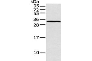 Gel: 12 % SDS-PAGE, Lysate: 40 μg, Lane: Mouse pancreas tissue, Primary antibody: ABIN7128589(ATP4B Antibody) at dilution 1/250 dilution, Secondary antibody: Goat anti rabbit IgG at 1/8000 dilution, Exposure time: 1 minute (ATP4b 抗体)