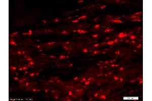 Formalin-fixed and paraffin-embedded rat colitis labeled with Anti-Phospho-IRF3 (Ser396) Polyclonal Antibody, Unconjugated (ABIN742688) 1:200, overnight at 4°C, The secondary antibody was Goat Anti-Rabbit IgG, Cy3 conjugated used at 1:200 dilution for 40 minutes at 37°C.