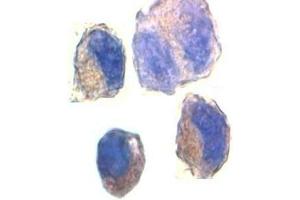 Immunocytochemical staining of K562 cells with ADAM10 antibody at 2ug/ml. (ADAM10 抗体)