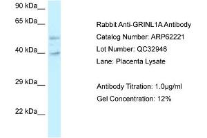 Western Blotting (WB) image for anti-Glutamate Receptor, Ionotropic, N-Methyl D-Aspartate-Like 1A (GRINL1A) (C-Term) antibody (ABIN2789069) (POLR2M 抗体  (C-Term))
