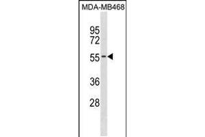 Western blot analysis in MDA-MB468 cell line lysates (35ug/lane). (KCNK6 抗体  (C-Term))
