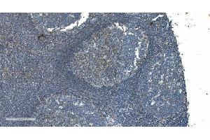 IHC analysis of TIMM8A/DDP using anti-TIMM8A/DDP antibody (ABIN7600039). (TIMM8A/DDP 抗体  (AA 14-97))