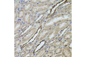 Immunohistochemistry of paraffin-embedded rat kidney using CHRFAM7A antibody (ABIN5975203) at dilution of 1/100 (40x lens). (CHRFAM7A 抗体)