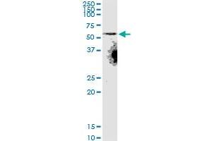 Western Blotting (WB) image for anti-Solute Carrier Family 22 (Organic Anion Transporter), Member 8 (SLC22A8) (AA 256-325) antibody (ABIN522838)