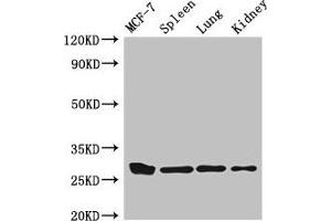 Western Blot Positive WB detected in: MCF-7 whole cell lysate, Mouse spleen tissue, Mouse lung tissue, Mouse kidney tissue All lanes: CMA1 antibody at 3 μg/mL Secondary Goat polyclonal to rabbit IgG at 1/50000 dilution Predicted band size: 28, 15 kDa Observed band size: 28 kDa (CMA1 抗体  (AA 22-247))