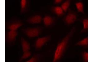 Immunofluorescence staining of methanol-fixed HeLa cells using GATA1 (phospho-Ser310) antibody (E011042, Red) (GATA1 抗体  (pSer310))
