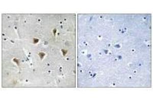 Immunohistochemistry analysis of paraffin-embedded human brain tissue using MTERF antibody. (MTERF 抗体)
