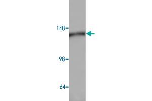 Western blot analysis of HeLa cell lysate with AP3D1 polyclonal antibody  at 1:500 dilution. (AP3D1 抗体)