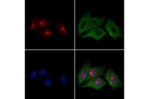 ABIN6261251 and ABIN6279172 staining Hela cells by IF/ICC.