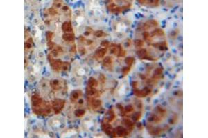 Used in DAB staining on fromalin fixed paraffin-embedded Kidney tissue (BMP6 抗体  (AA 375-513))