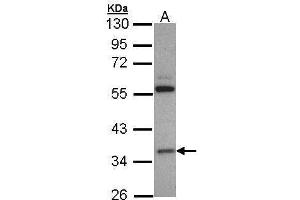 Western Blotting (WB) image for anti-3-Hydroxymethyl-3-Methylglutaryl-CoA Lyase (HMGCL) (full length) antibody (ABIN2856650)