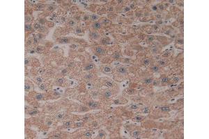 Used in DAB staining on fromalin fixed paraffin- embedded liver tissue (CYP26B1 抗体  (AA 1-512))
