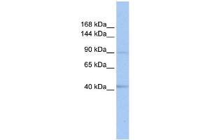 WB Suggested Anti-SENP6 Antibody Titration:  0. (SENP6 抗体  (C-Term))