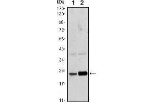 Western blot analysis using Rab10 mouse mAb against Hela (1) and NIH/3T3 (2) cell lysate.