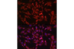 Immunofluorescence analysis of C6 cells using R Rabbit pAb (ABIN6132924, ABIN6146720, ABIN6146721 and ABIN6214772) at dilution of 1:100 (40x lens).
