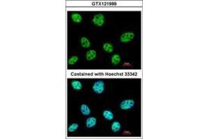 Image no. 2 for anti-Polymerase (RNA) III (DNA Directed) Polypeptide E (80kD) (POLR3E) (AA 89-323) antibody (ABIN1500341) (POLR3E 抗体  (AA 89-323))