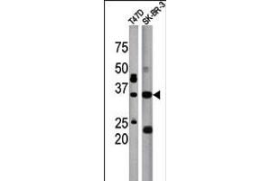 Antibody is used in Western blot to detect ICMT in T47D (left) and SK-BR-3 (right) tissue lysate (ICMT 抗体  (C-Term))