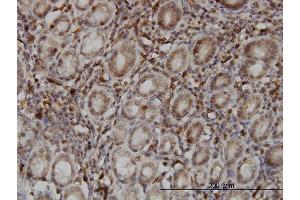 Immunostaining (ISt) image for anti-SUMO1/sentrin Specific Protease 6 (SENP6) (AA 1-110) antibody (ABIN565219)