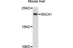 Western blot analysis of extracts of mouse liver cells, using SSSCA1 antibody. (SSSCA1 抗体)
