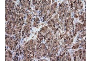 Image no. 2 for anti-Alcohol Dehydrogenase 1B (Class I), beta Polypeptide (ADH1B) antibody (ABIN1496479) (ADH1B 抗体)