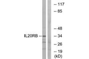 Western Blotting (WB) image for anti-Interleukin 20 Receptor beta (IL20RB) (AA 141-190) antibody (ABIN2889969) (IL20RB 抗体  (AA 141-190))