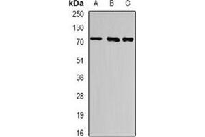 Western blot analysis of ATF6 expression in K562 (A), PC3 (B), mouse heart (C) whole cell lysates. (ATF6 抗体)