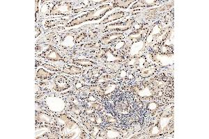 IHC analysis of SNRNP27 using anti-SNRNP27 antibody (ABIN7599614).