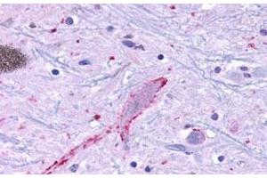 Immunohistochemical (Formalin/PFA-fixed paraffin-embedded sections) staining in human brain, neurons and glia with MRGF polyclonal antibody . (Mrgprf 抗体  (C-Term))