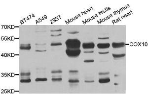 Western blot analysis of extracts of various cell lines, using COX10 antibody. (COX10 抗体)