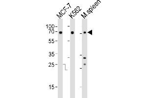 Western blot analysis of lysates from MCF-7, K562 cell line and mouse spleen tissue(from left to right), using RBBP5 Antibody (C-term) (ABIN6242596 and ABIN6577711). (RBBP5 抗体  (C-Term))