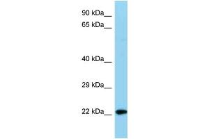 WB Suggested Anti-Ndufb8 Antibody   Titration: 1. (NDUFB8 抗体  (C-Term))