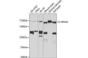 Western blot analysis of extracts of various cell lines, using NFASC antibody (ABIN3017266, ABIN3017267, ABIN3017268 and ABIN6220017) at 1:1000 dilution. (NFASC 抗体  (AA 830-1100))