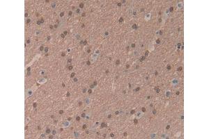 Used in DAB staining on fromalin fixed paraffin- embedded brain tissue (BCOR 抗体  (AA 1501-1755))
