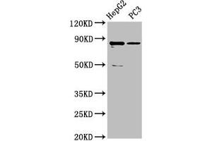 Western Blot Positive WB detected in: HepG2 whole cell lysate, PC-3 whole cell lysate All lanes: CCDC170 antibody at 5 μg/mL Secondary Goat polyclonal to rabbit IgG at 1/50000 dilution Predicted band size: 83 kDa Observed band size: 83 kDa (CCDC17 抗体  (AA 574-651))