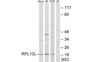 Western Blotting (WB) image for anti-Ribosomal Protein L10L (RPL10L) (C-Term) antibody (ABIN1850609) (RPL10L 抗体  (C-Term))